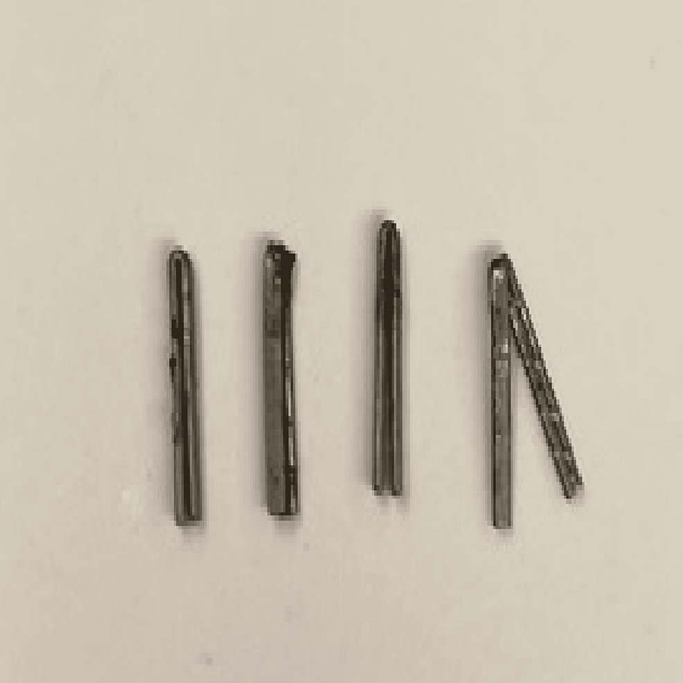 The-extracted-foreign-bodies-included-four-titanium-staples-with-no-apparent-abnormalities