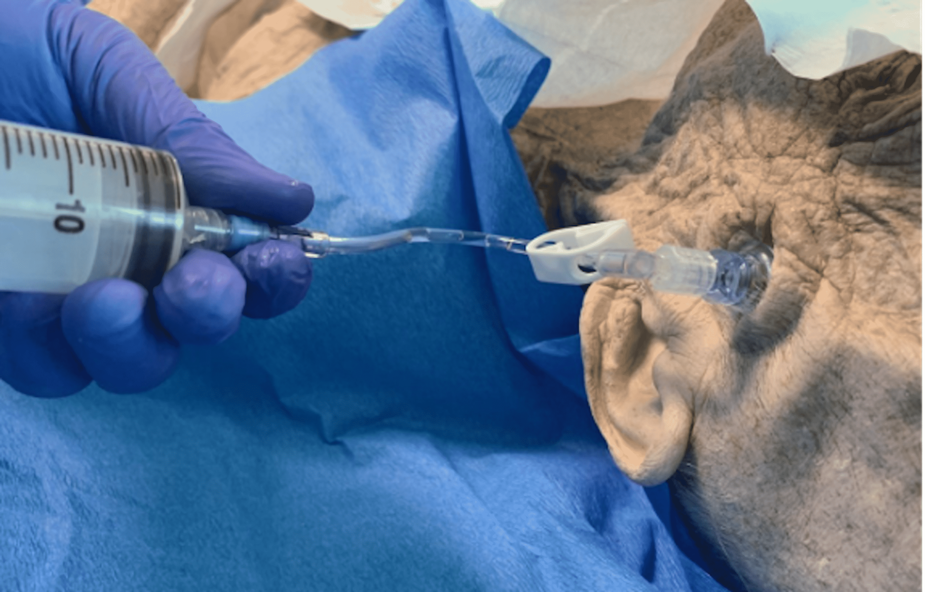 Cureus Emergency Craniostomy “Burr Hole” Using an