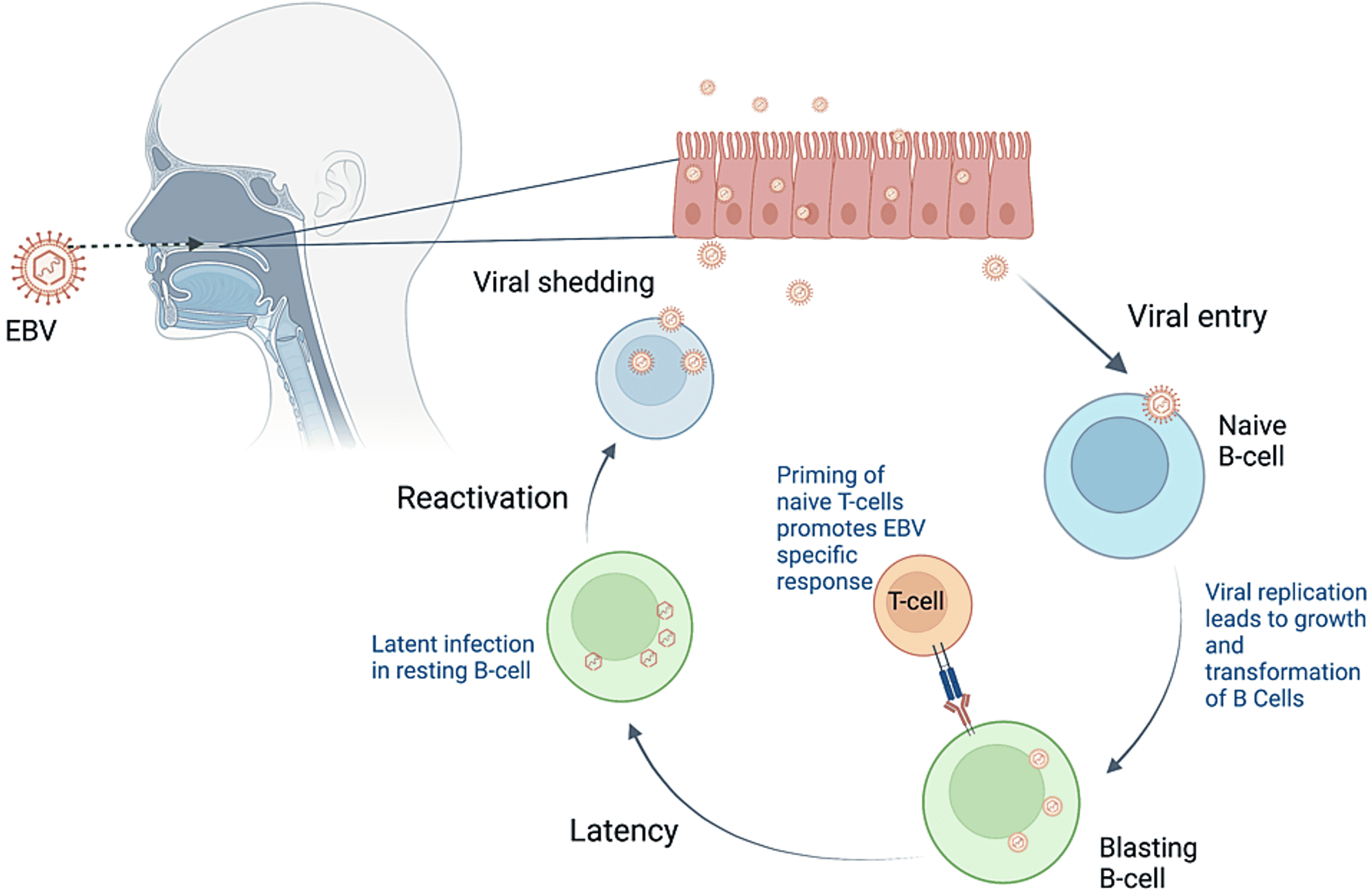 Cureus Epstein Barr Virus Reactivation Causing Cholestatic Hepatitis 1528