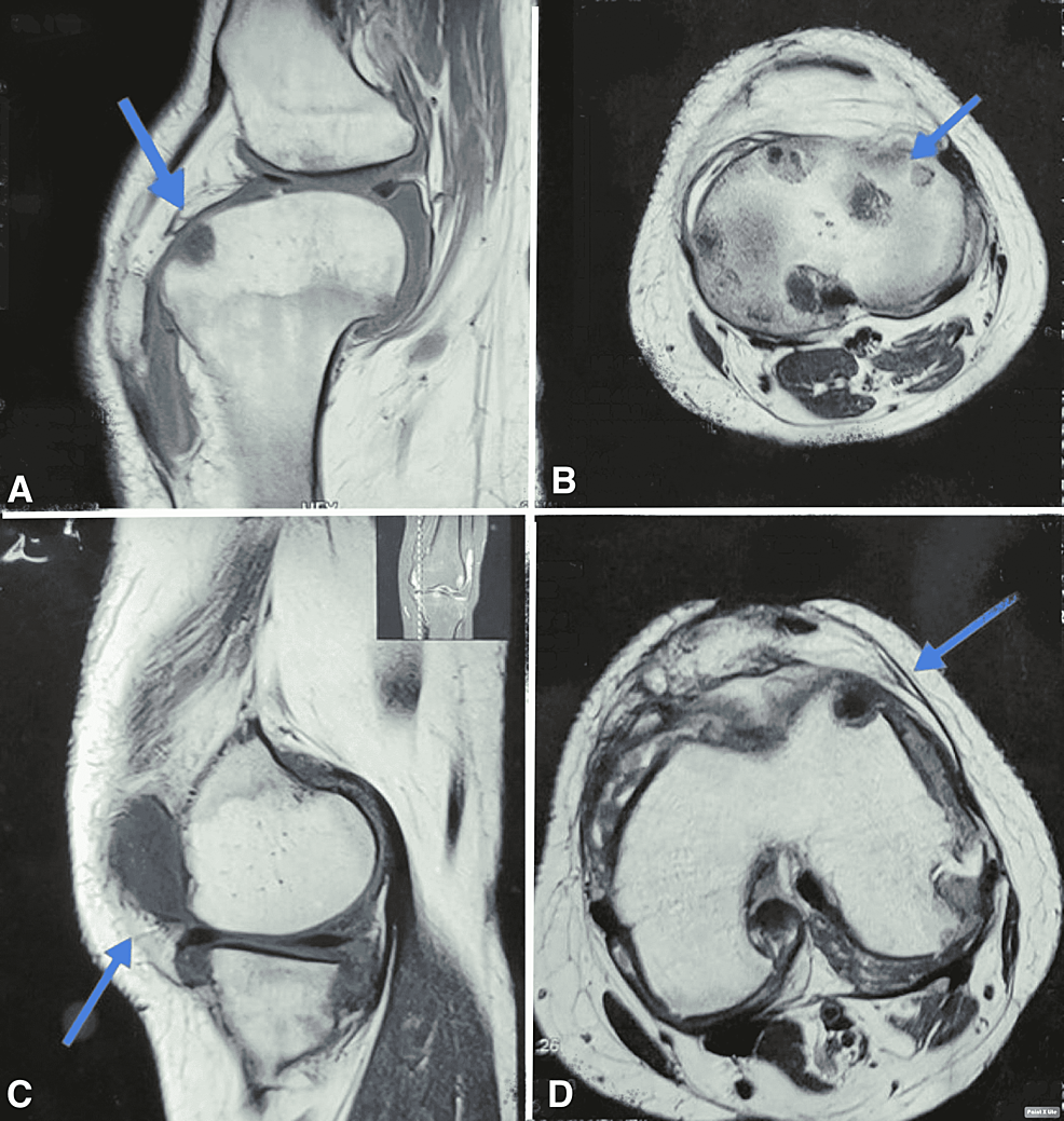 T1/T2-weighted-MRI-images-of-knee-joint.