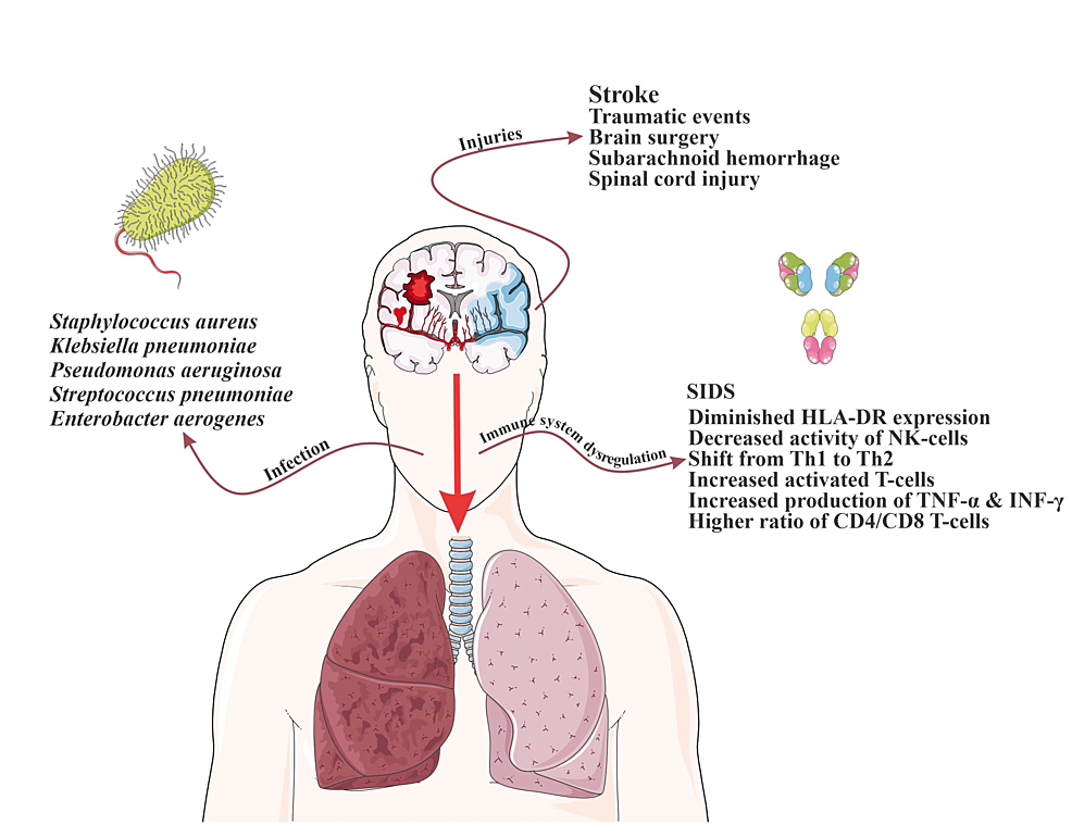The-Main-Pathophysiology-of-Pneumonia-in-CNS-Injuries