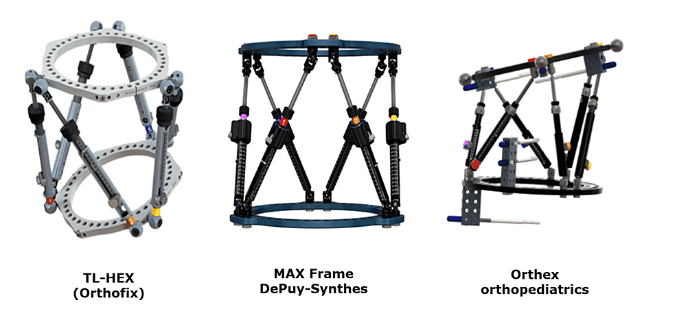 TL-HEX TrueLok Hexapod System - Orthofix