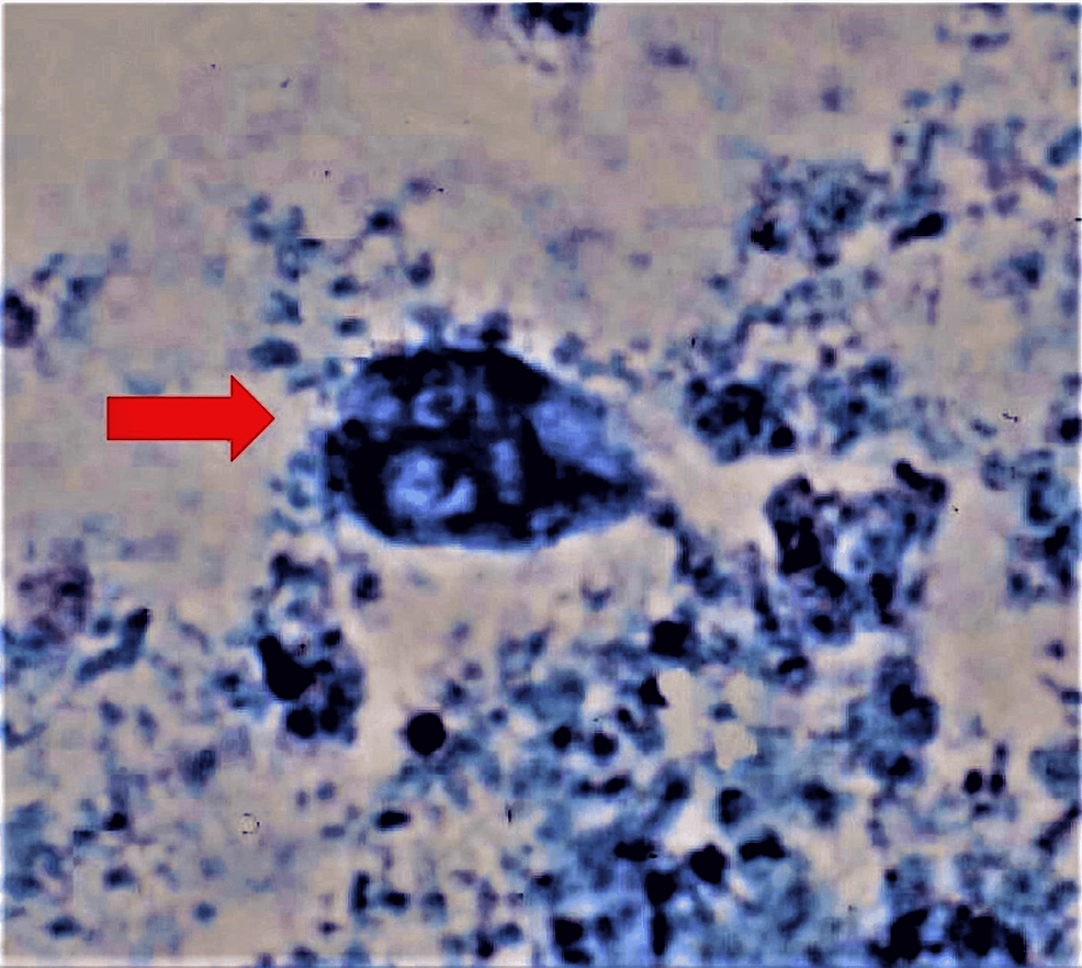 Giardia-trophozoite-under-light-microscopy-(methylene-blue-stain)