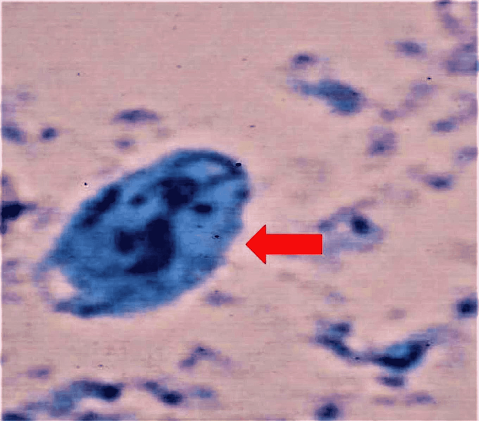 Giardia-cyst-under-light-microscopy-(methylene-blue-stain)
