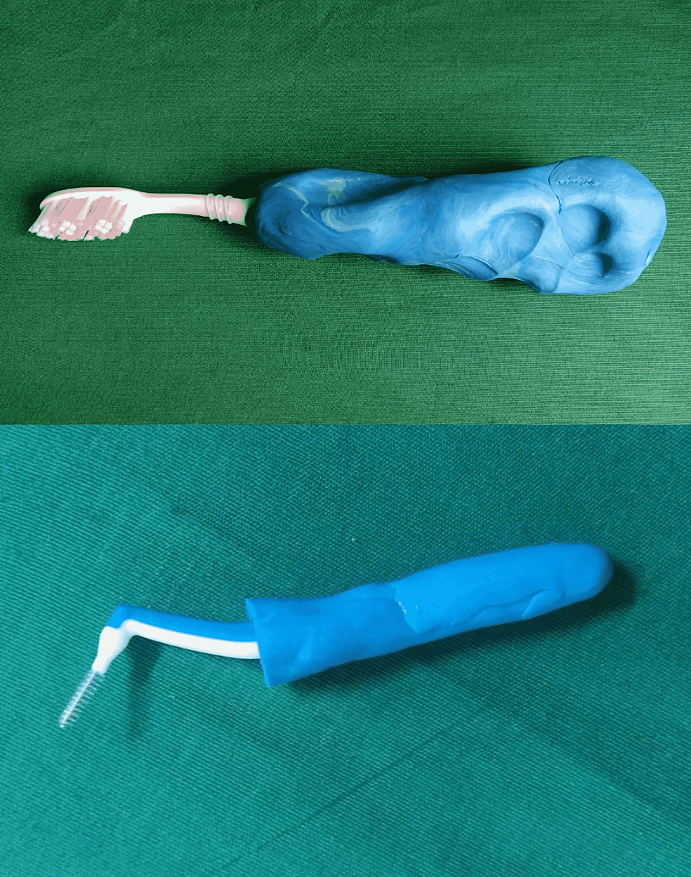 Molded-handle-around-toothbrush-and-interproximal-brush.