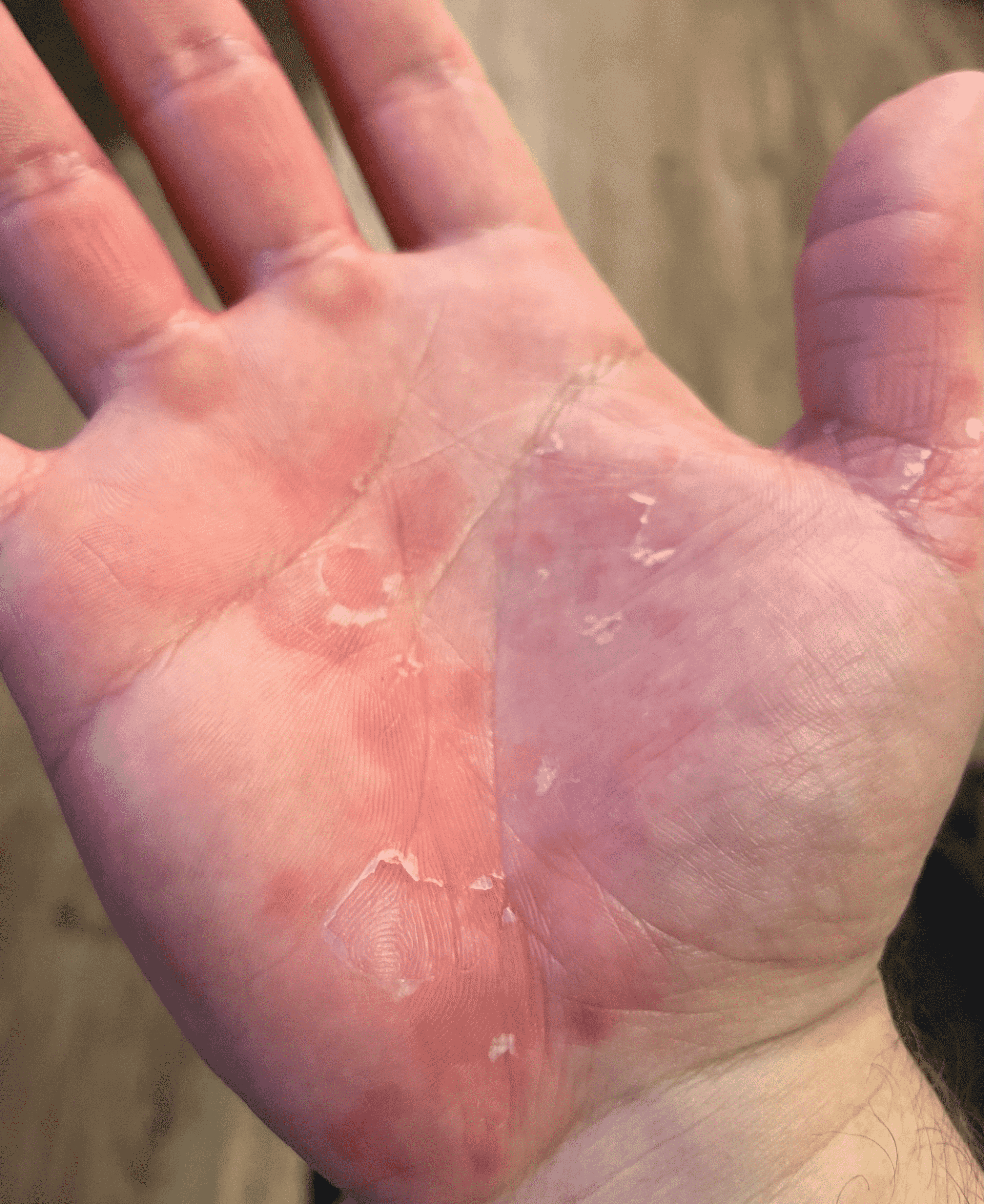 do vitamin patches work reddit