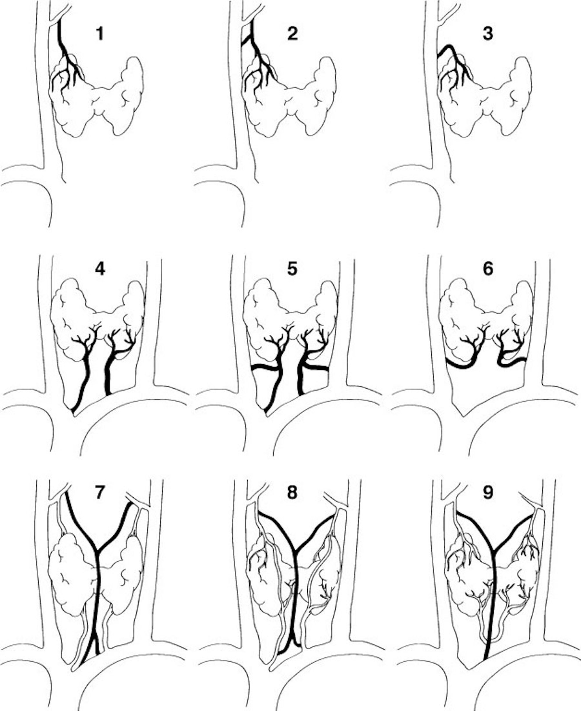 cureus review of the variations of the superficial veins of the neck veins in neck