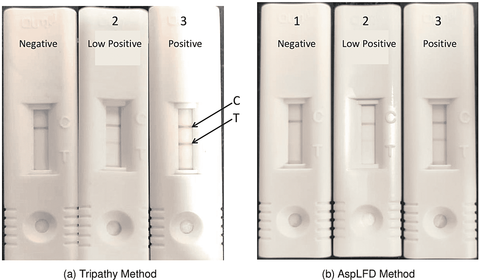 Results-of-MP-LFA-showing-representative-(1)-negative,-(2)-low-positive,-and-(3)-positive-results-in-paired-serum-samples-of-IA-patients-and-controls-by-the-(a)-Tripathy-method-and-(b)-AspLFD-method