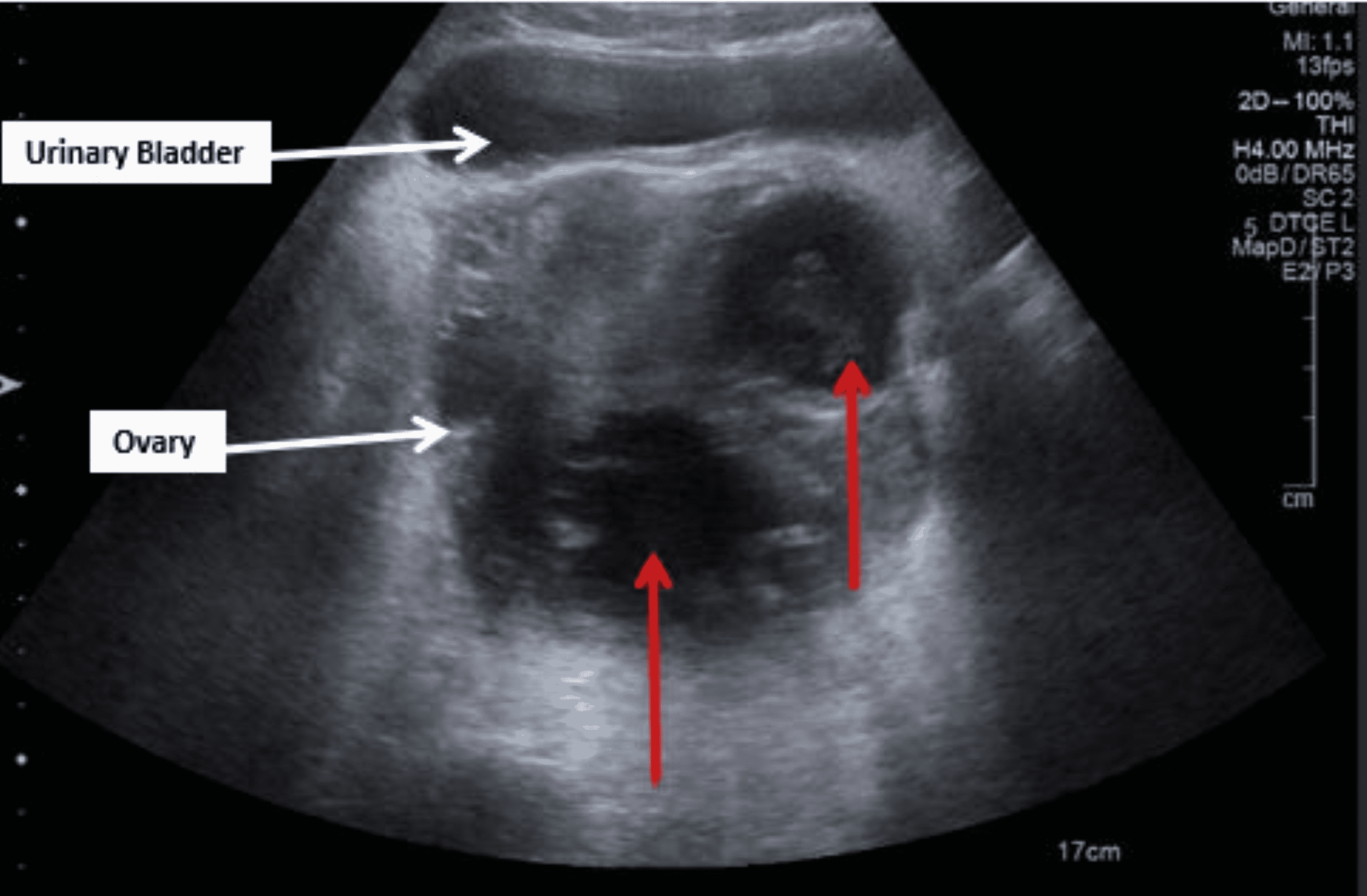 Thyroid Ultrasound Cpt 54 - g2qy4vg