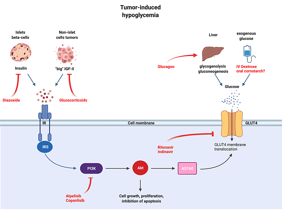 Mechanisms-of-tumor-induced-hypoglycemia-and-treatment-options.-Some-tumors-activate-the-insulin-signaling-pathway-(left-half-of-the-figure)-by-secretion-various-hormones-such-as-insulin,-GLP-1,-and-“big”-IGF-II.-Another-way-to-cause-hypoglycemia-is-by-metastasizing-to-the-liver,-adrenals,-and-pituitary-gland,-organs-that-control-glucose-homeostasis-(right-half-of-the-figure).-AKT-is-seen-in-the-middle,-transmitting-signals-from-the-insulin-receptor-to-translocate-GLUT4-and-internalize-glucose.-Treatment-options-are-shown-in-red,-such-as-glucocorticoids,-diazoxide,-glucagon,-and-dextrose-infusion.-Other-possible-options-are-also-shown,-such-as-protease-inhibitors-and-PI3K-inhibitors.
