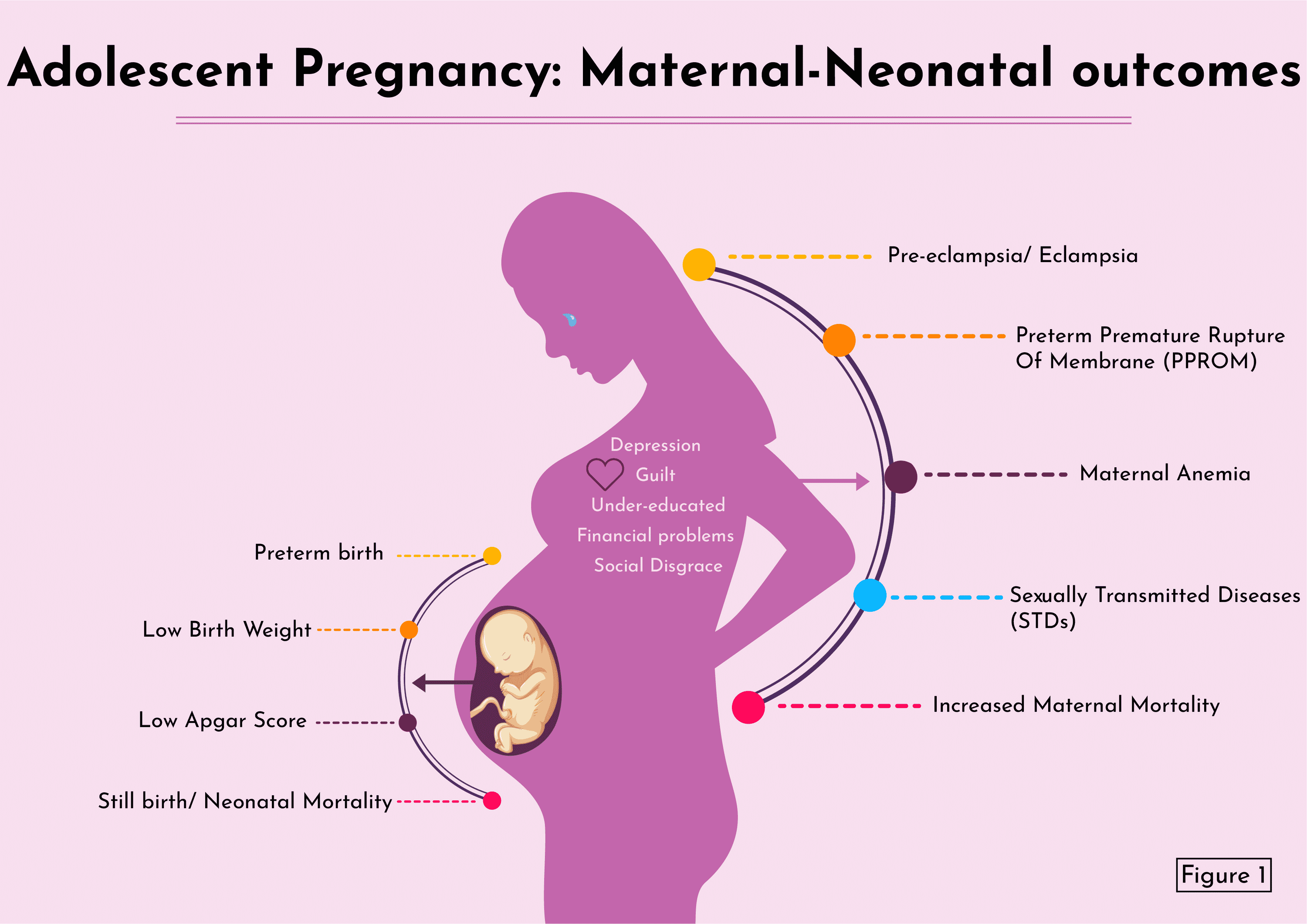 Cureus | Maternal and Neonatal Outcomes of Adolescent Pregnancy: A  Narrative Review
