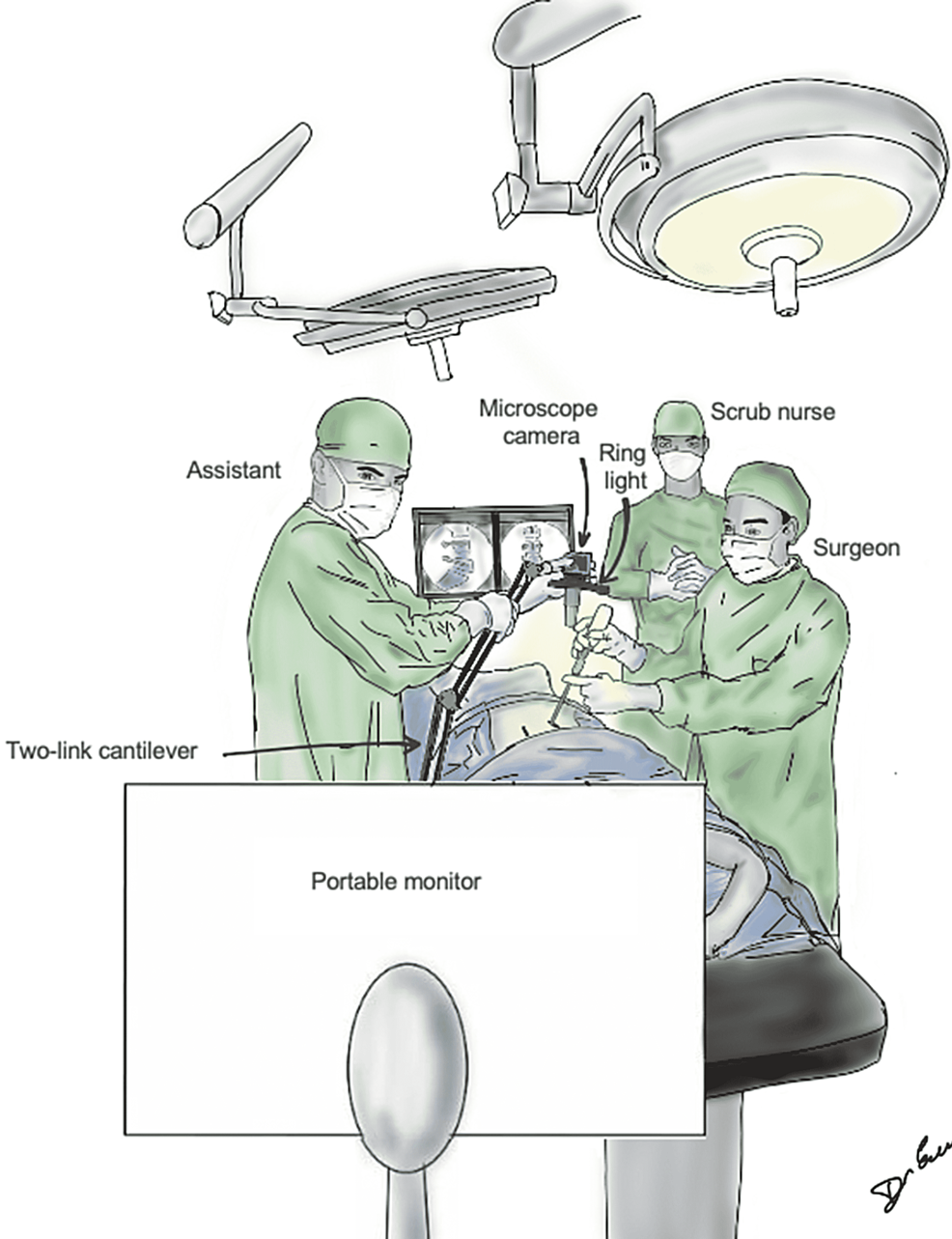 Graphical-illustration-of-the-operating-room-setup-during-the-exoscope-assisted-phase-of-the-surgery.