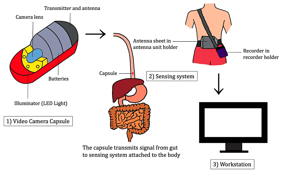 Video-capsule-endoscopy-system.