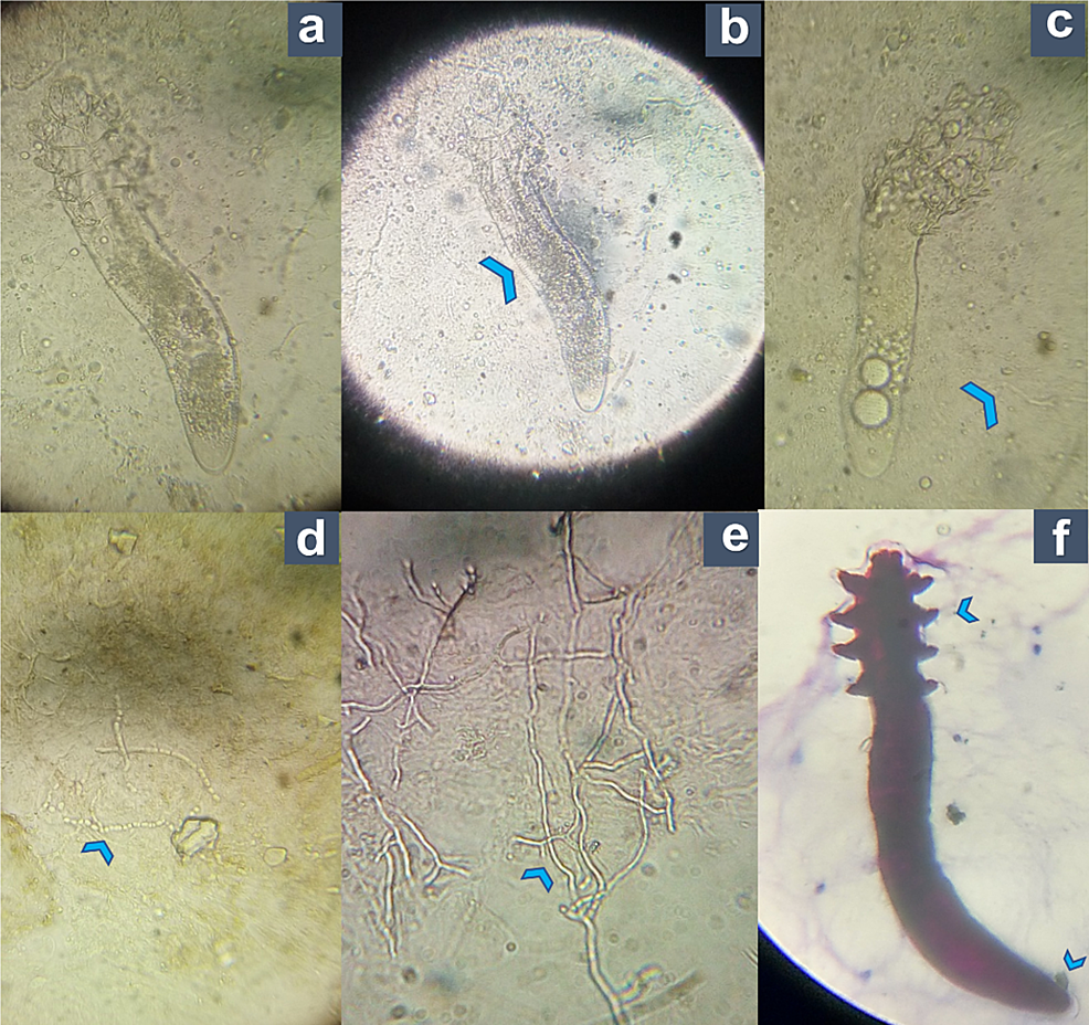 24 best images about Demodex Mites and treatments on ...