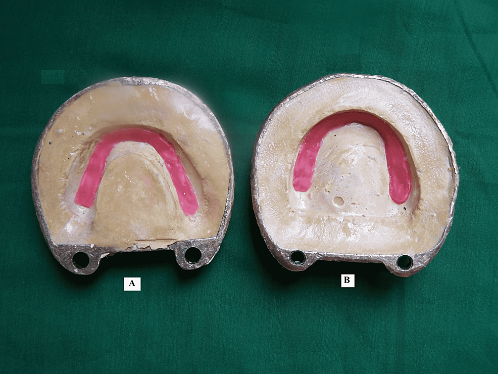 Cera fundida-derada-en-impresión-dientes:-A)-mandibular;-B)-maxilar