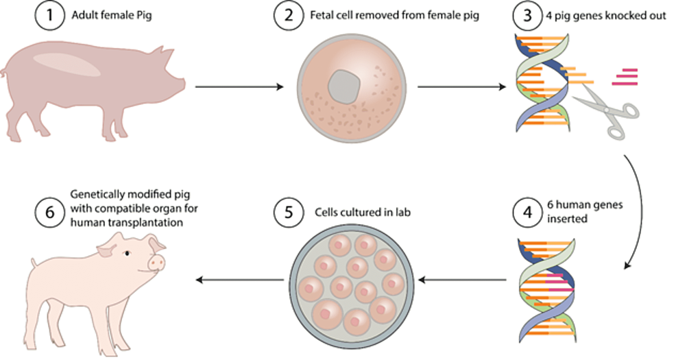 Cureus Evolution of Xenotransplantation as an Alternative to Shortage