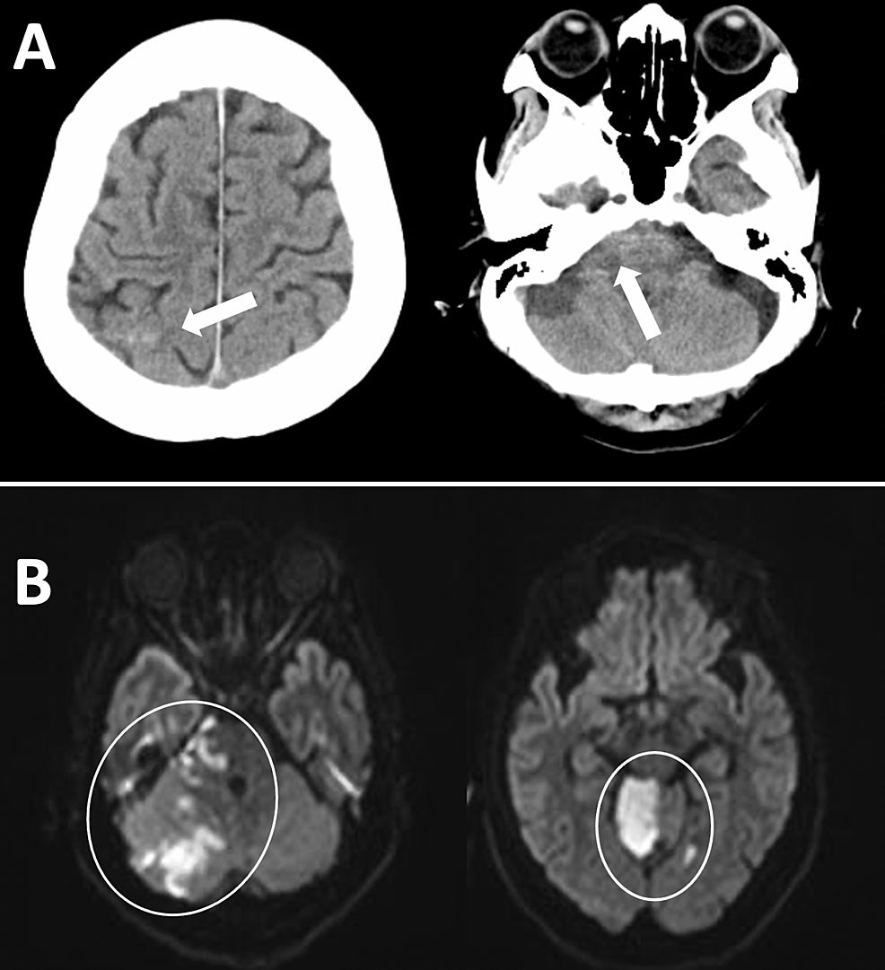 Neurodiagnostic-images