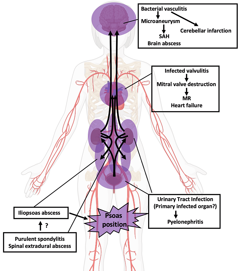 The-suggested-route-of-infection