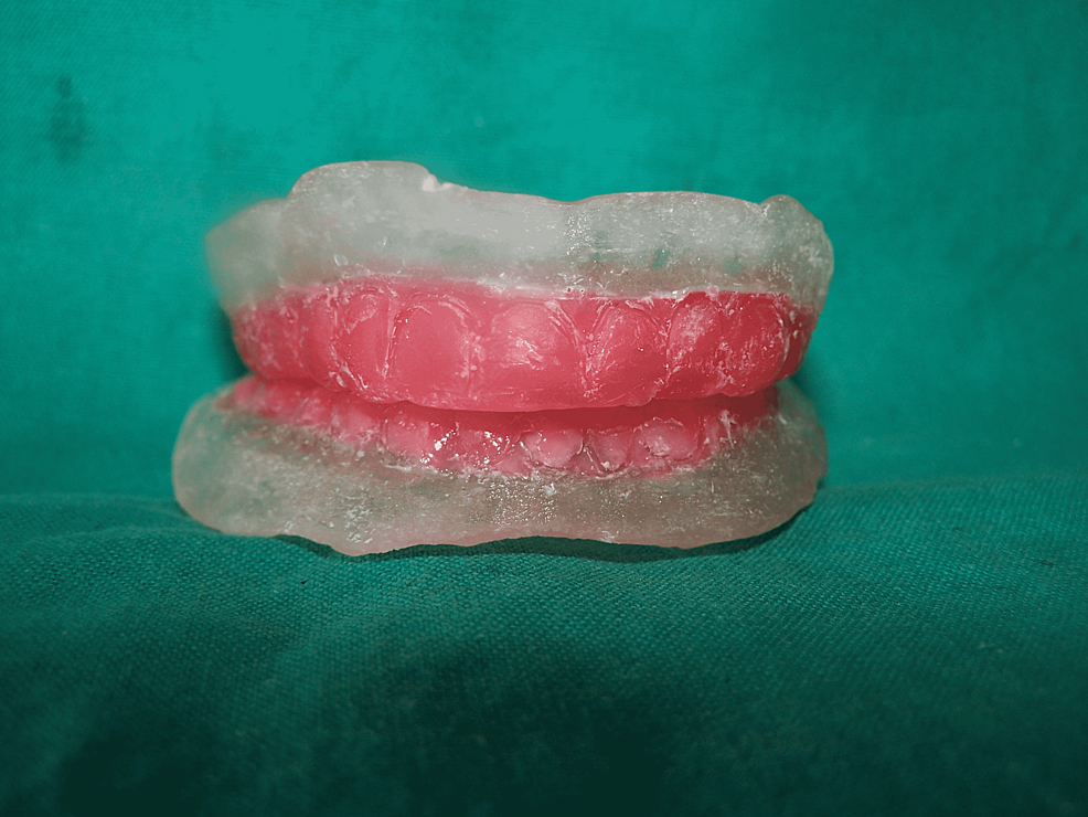 Template-dentures
