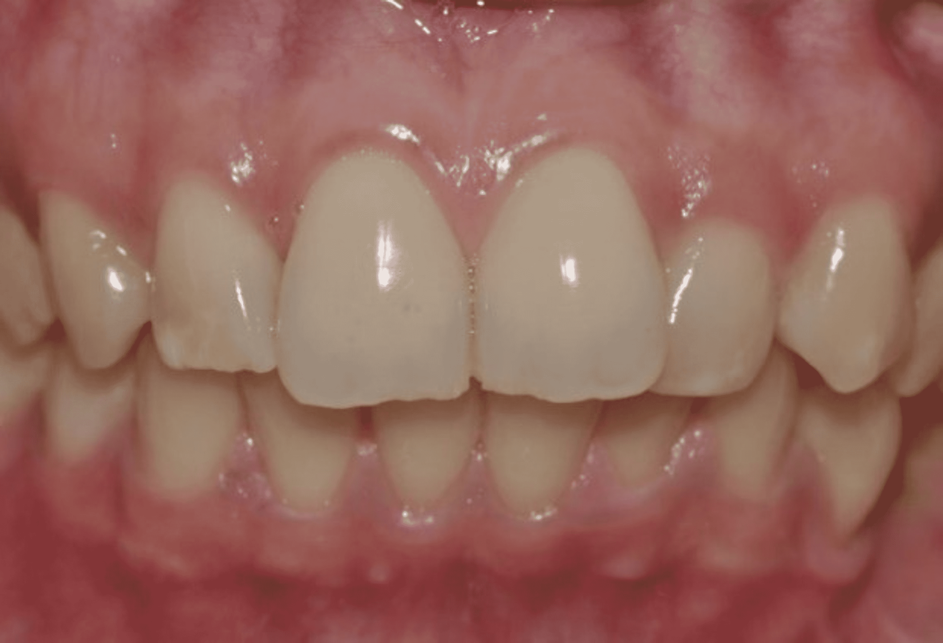 Cureus Modeling the Relationship Between Tooth Color and Skin Color