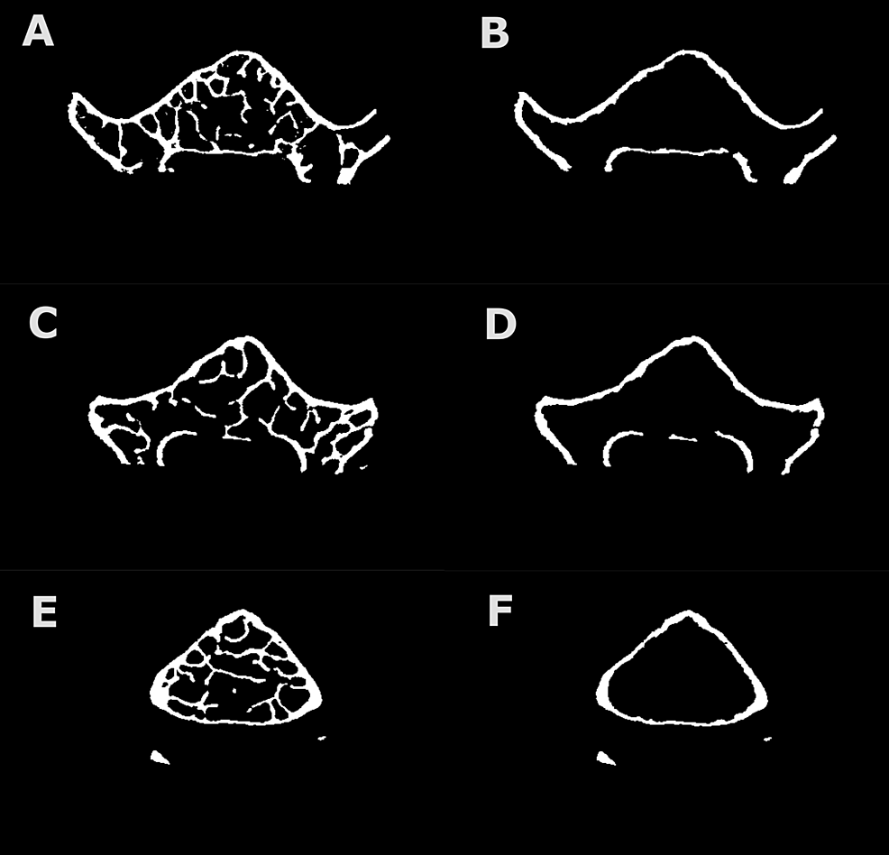 Deep learning-based segmentation of the thorax in mouse micro-CT scans