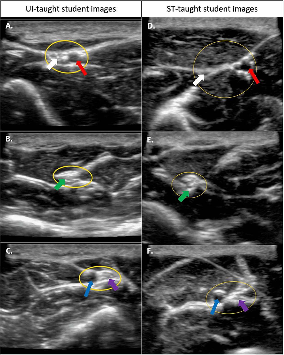 Comparing The Effectiveness And Image Quality Of Musculoskeletal   Article River A5c99930f9a711ecb3406f7b8f62c8fa Figures 