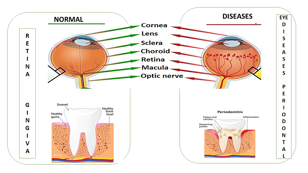 Normal-retina-and-periodontium-versus-retina-and-periodontium-with-diseases