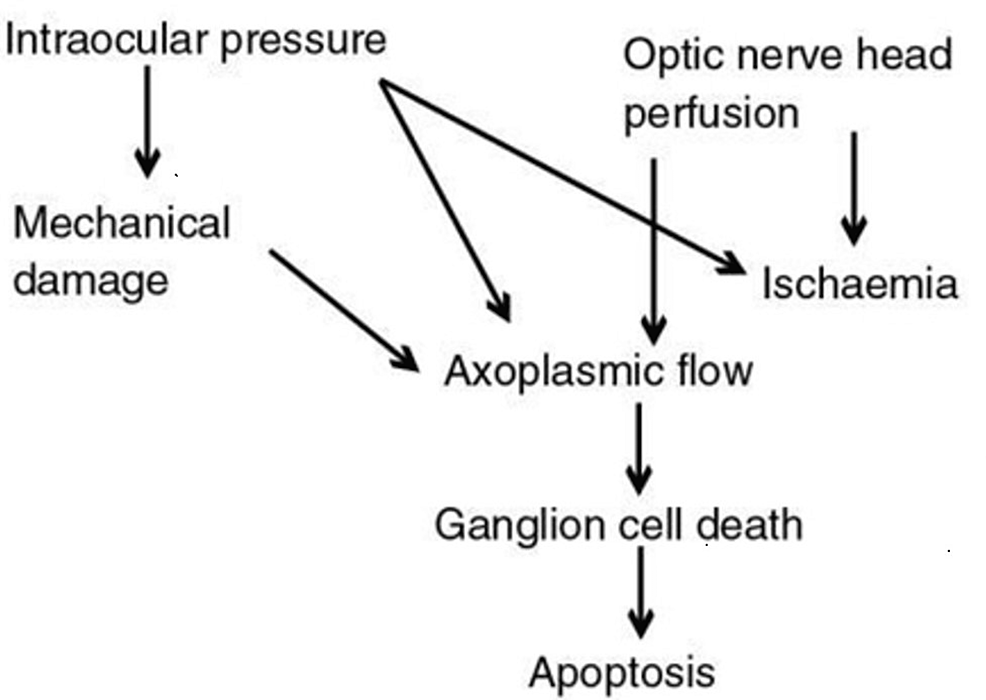 -Pathophysiology-of-glaucomatous-optic-nerve-damage