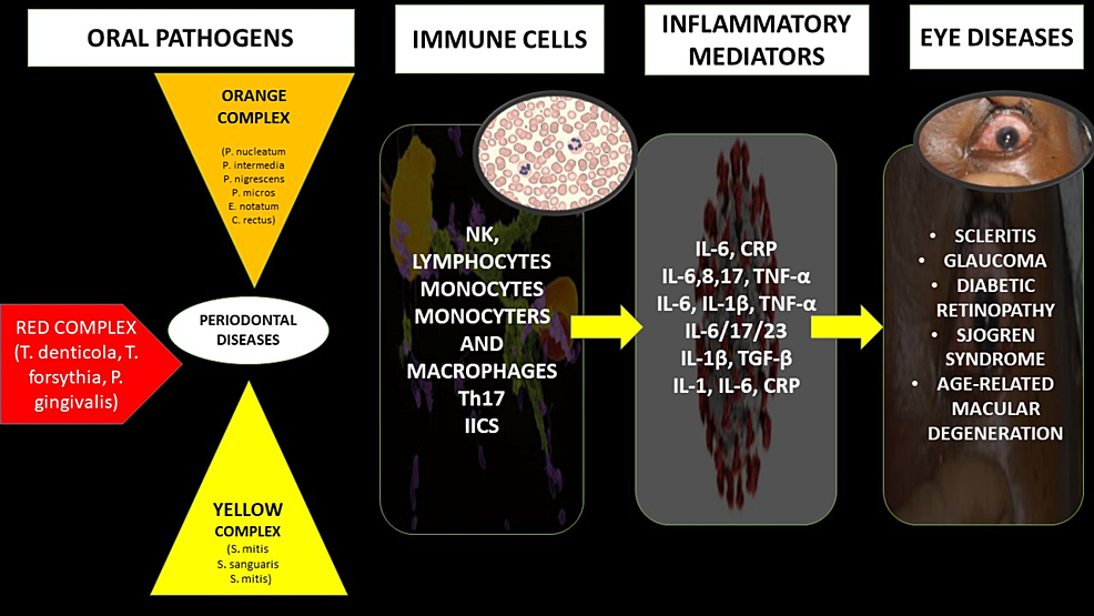 Involvement-of-oral-pathogens,-immune-cells,-and-altered-levels-of-inflammatory-mediators-in-different-eye-diseases