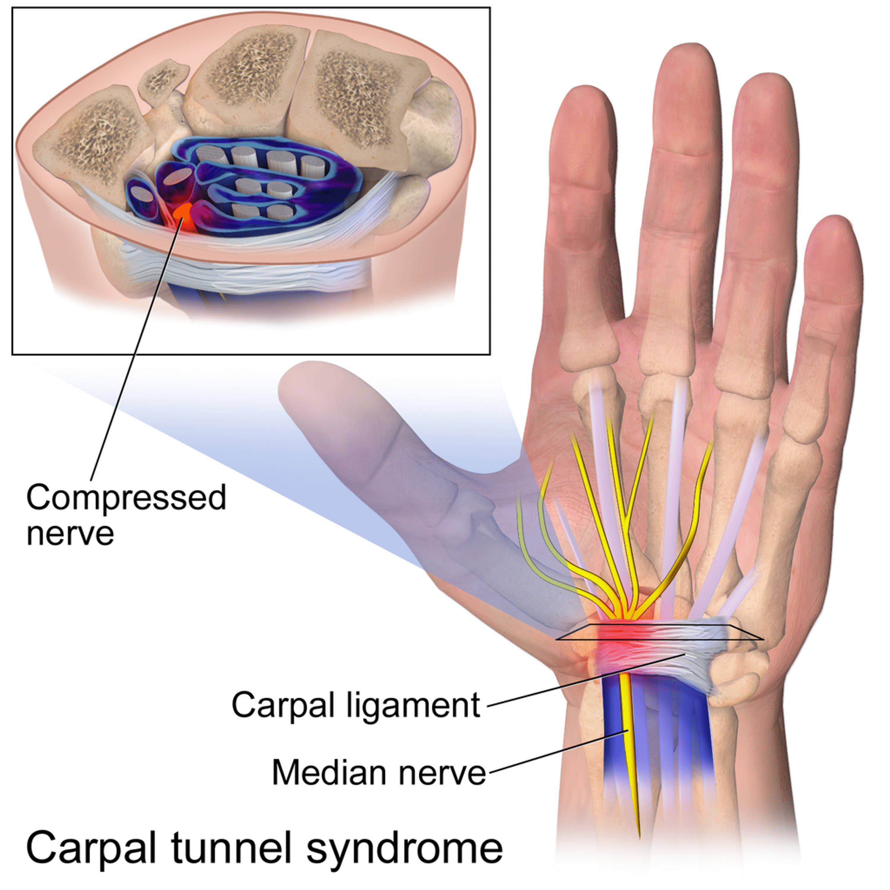 median nerve