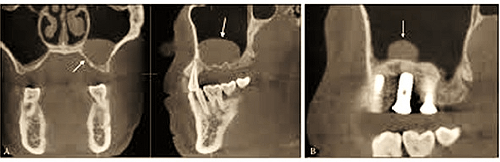CBCT-image-of-the-region.