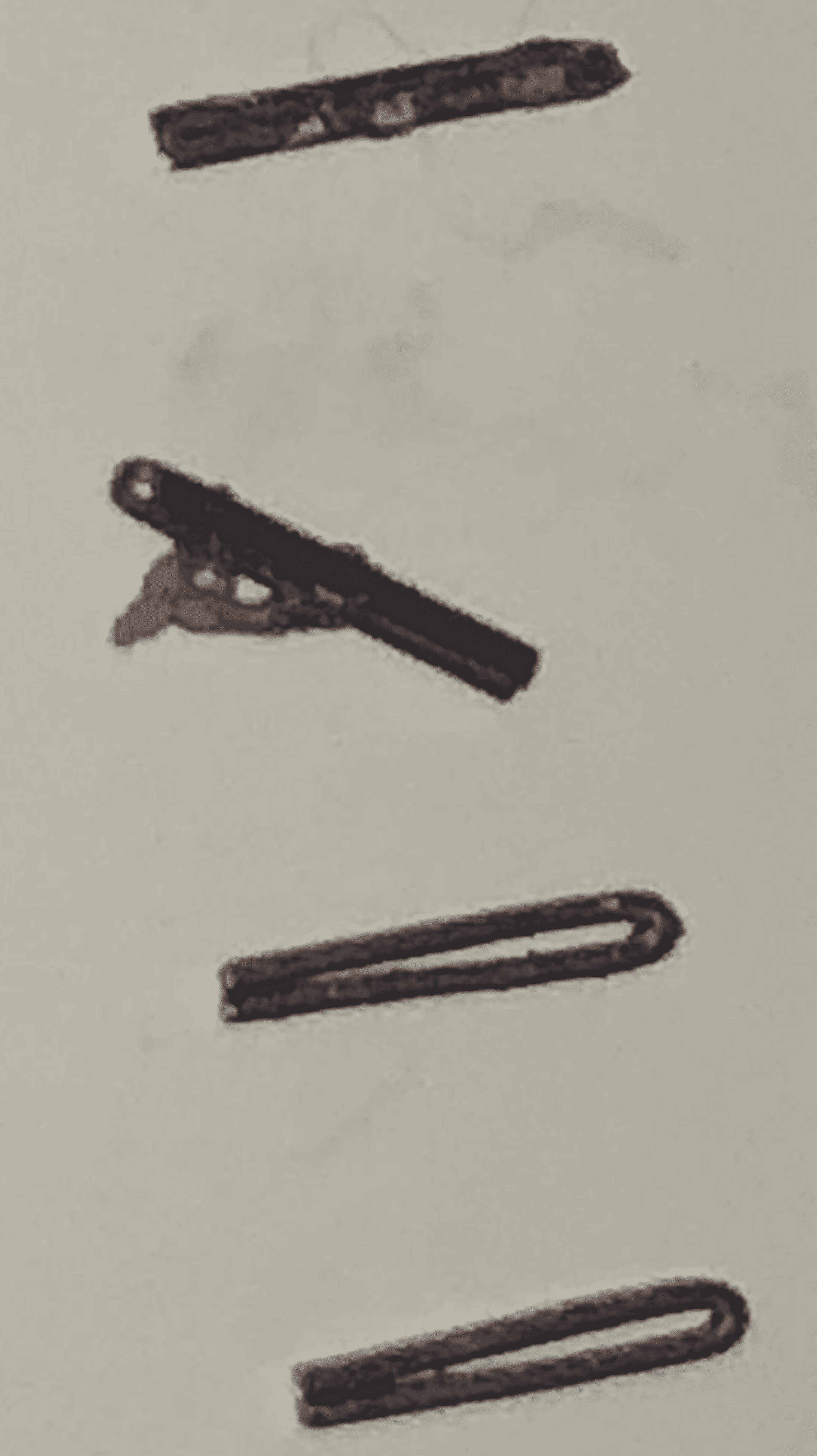 Cureus Mixed Metal Allergy Ancillary to Surgical Staples