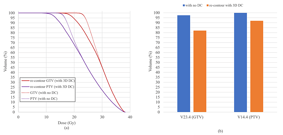 Dose-volume-histogram-(DVH)-and-dose-coverage-of-PTV-and-GTV