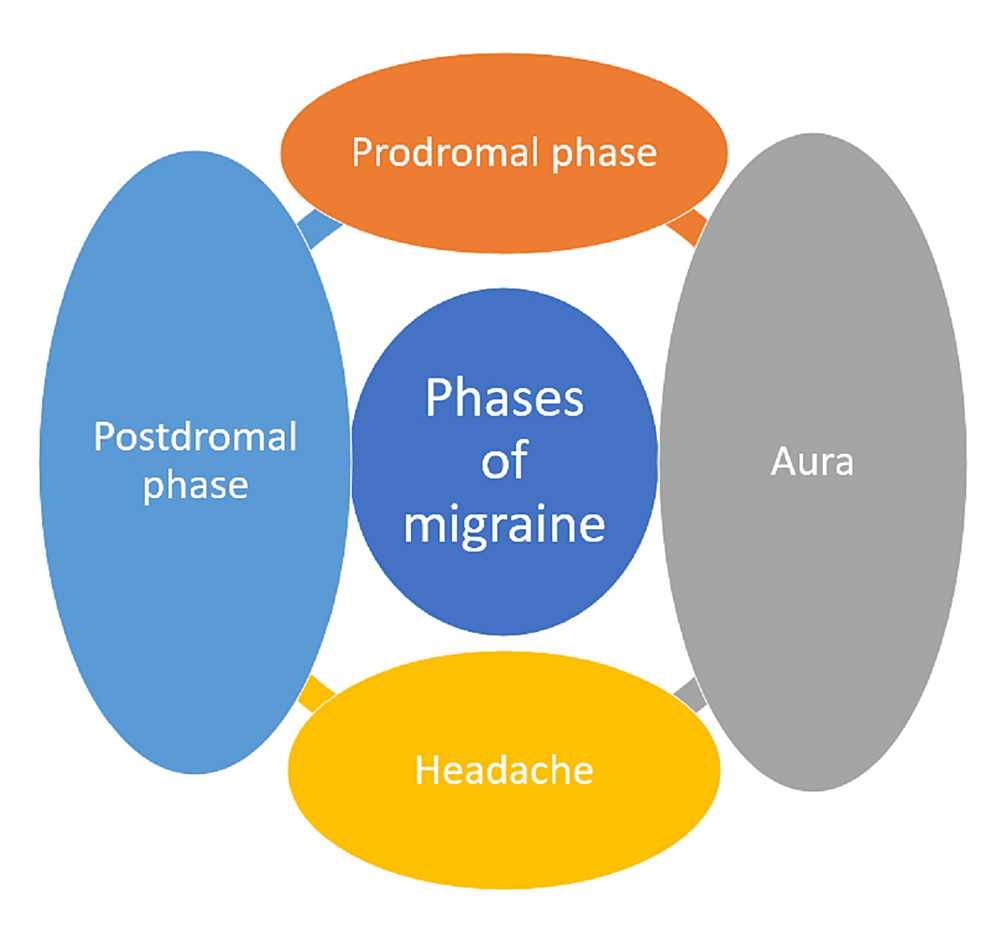 Cureus Migraine An Underestimated Neurological Condition Affecting