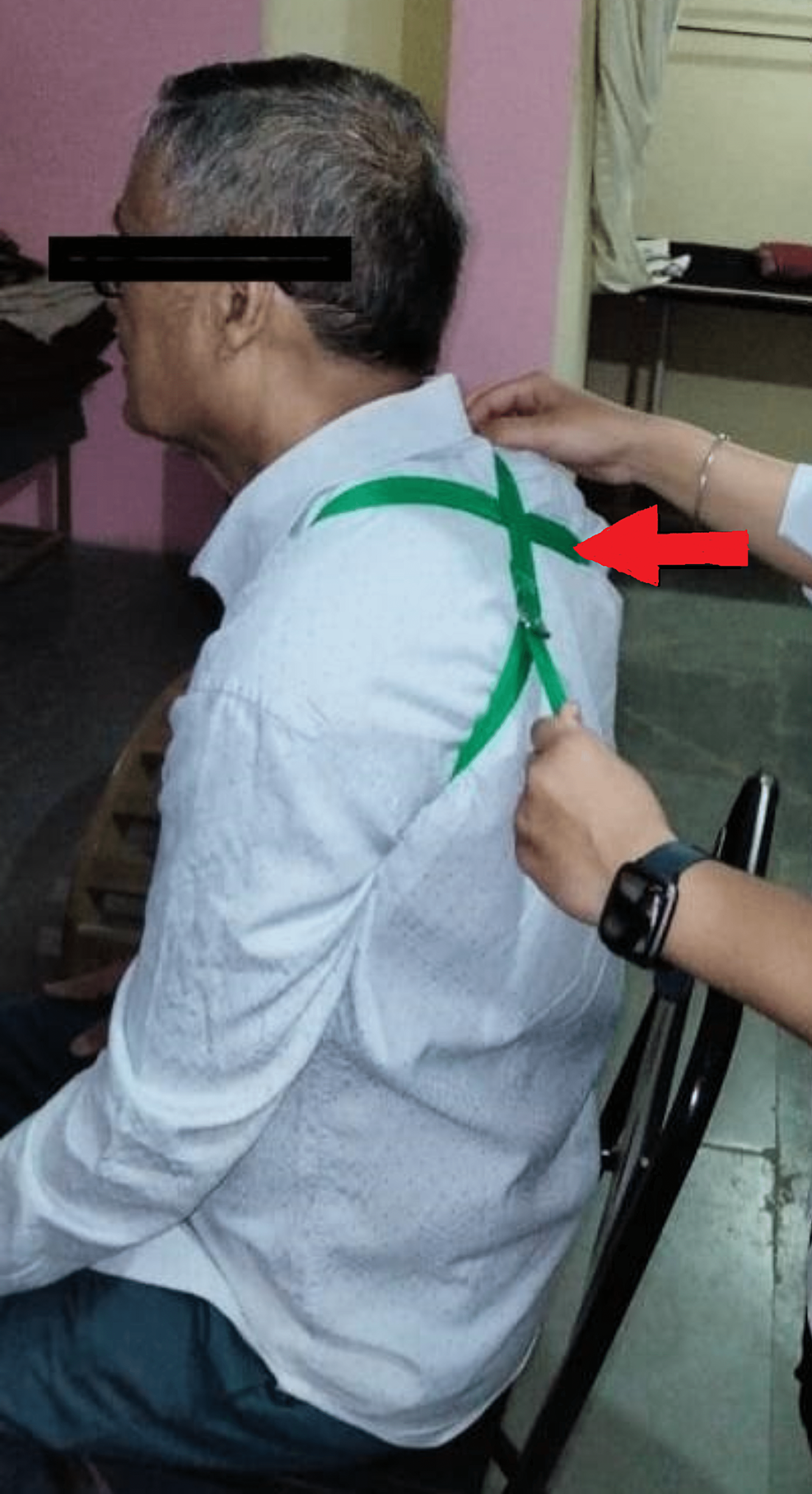 Cureus Impact of Scapular Repositioning Using a Scapular Belt for