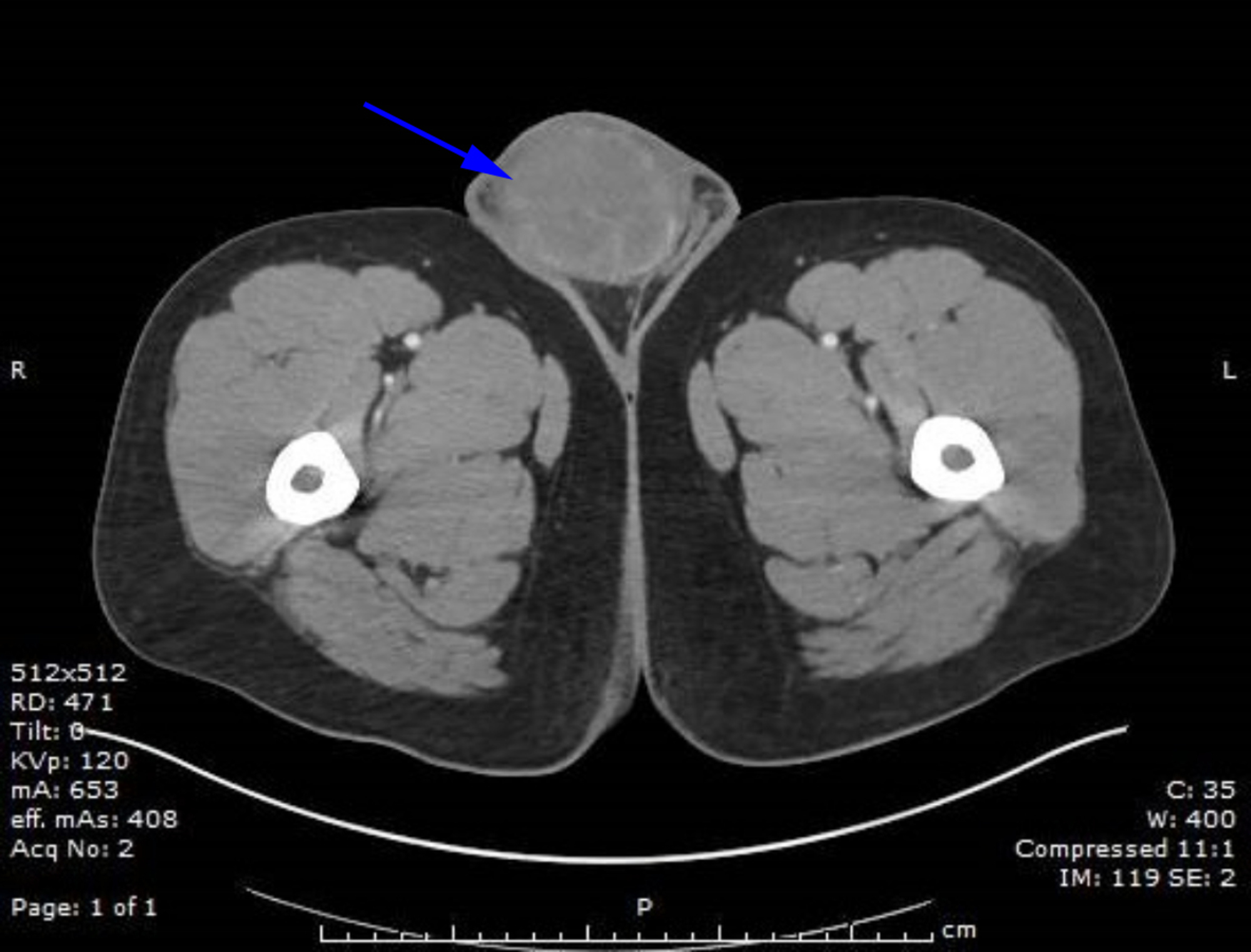 Testicular Anatomy Images