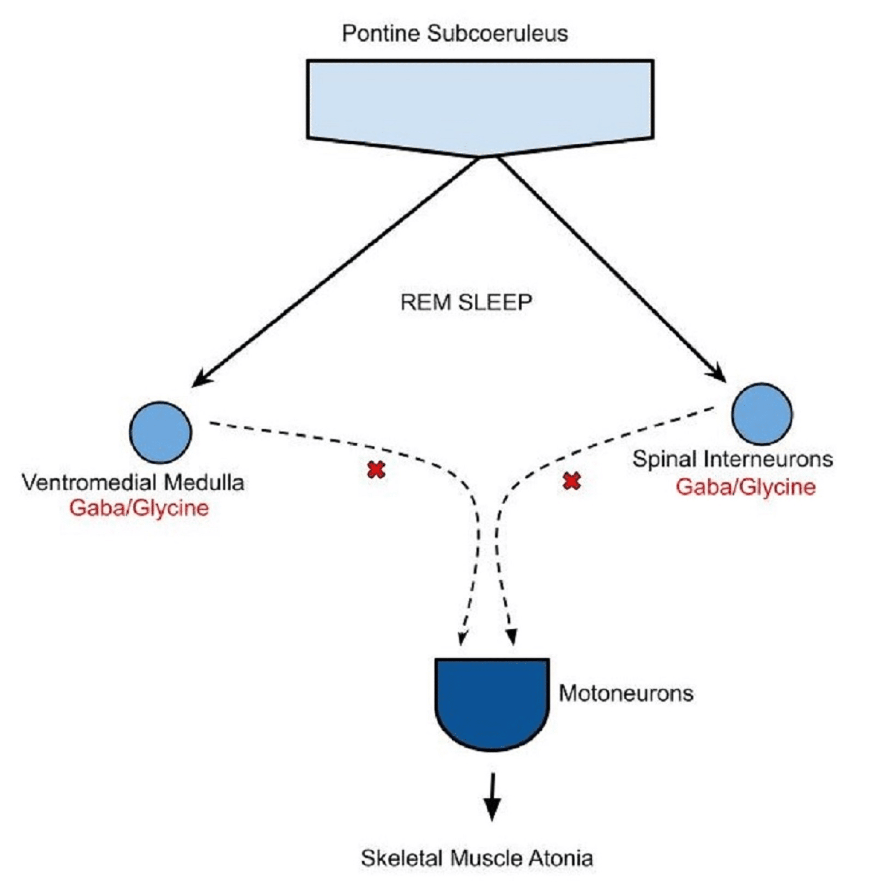 Cureus Intraoral Neuromuscular Stimulation Device and Rapid Eye MovementDependent Obstructive