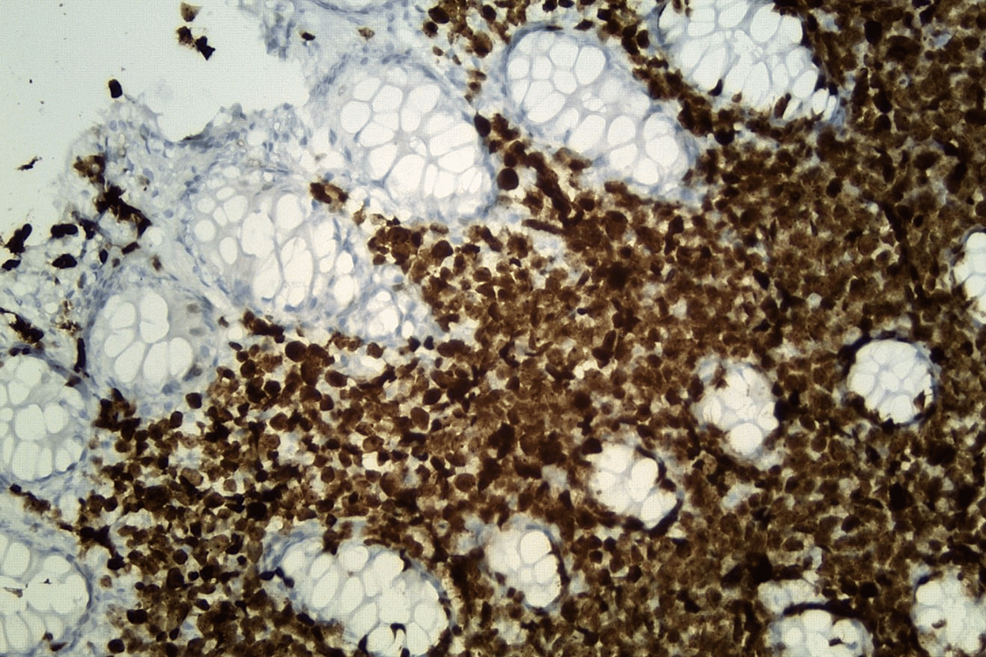 Histological-section-of-colonic-mucosa-with-Ki-67-immunohistochemical-stain-(original-magnification,-x-400).