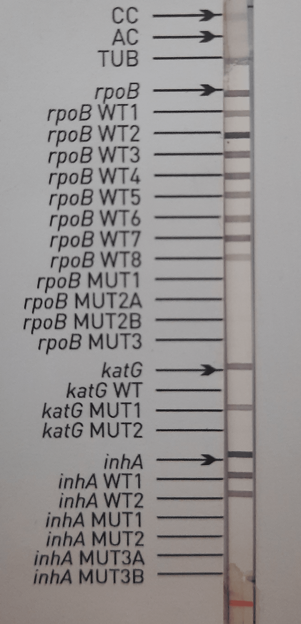 Rifampicin-sensitive-INH-resistant-isolate-showing-the-presence-of-katG-MUT1-band-and-absence-of-katG-WT-band,-indicating-mutation-at-the-S315T1-codon-of-the katG-gene