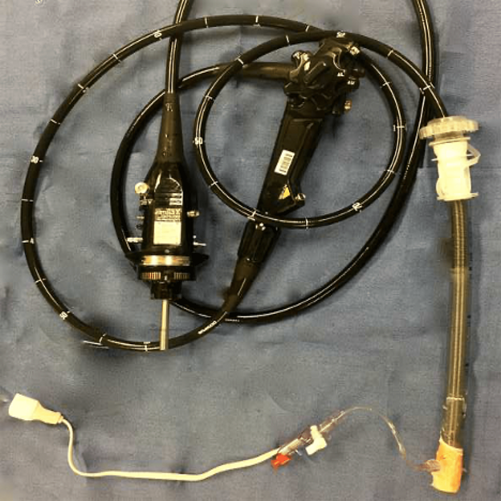 Cureus Gas Pressure From the Endoscope An Unexplored Contributor to