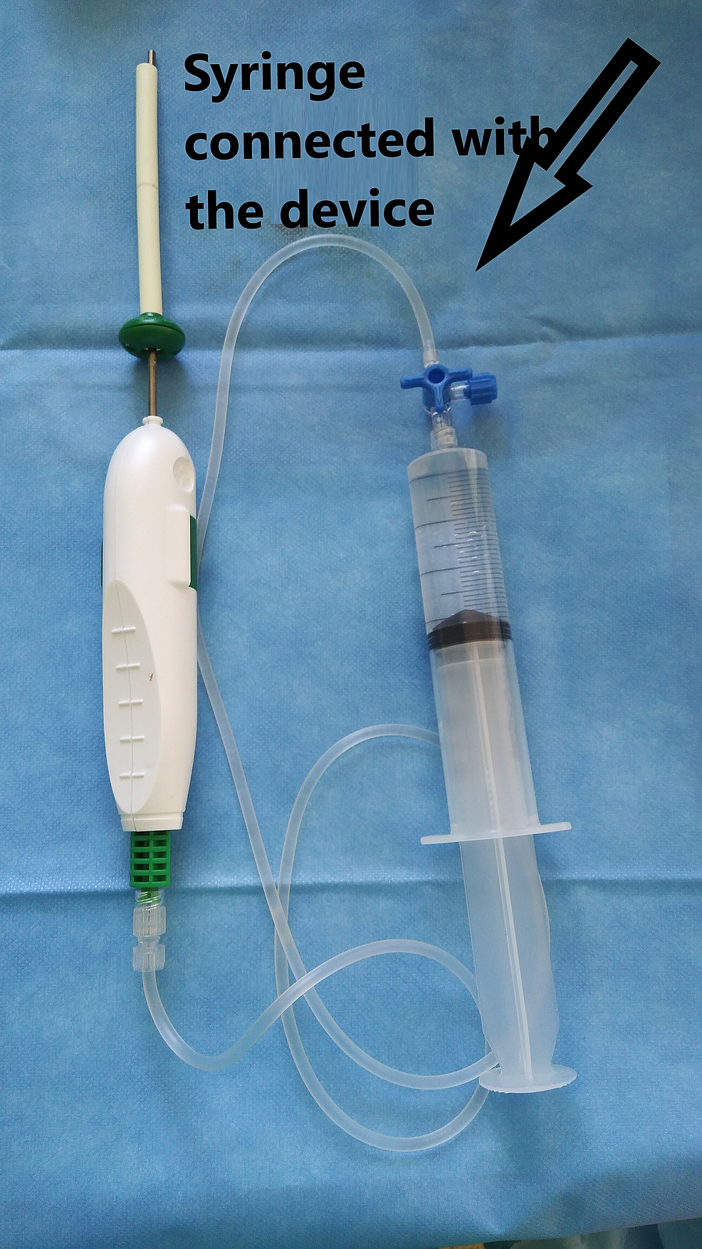 Cureus Technical Report Biodegradable Spacer Device for Irreparable