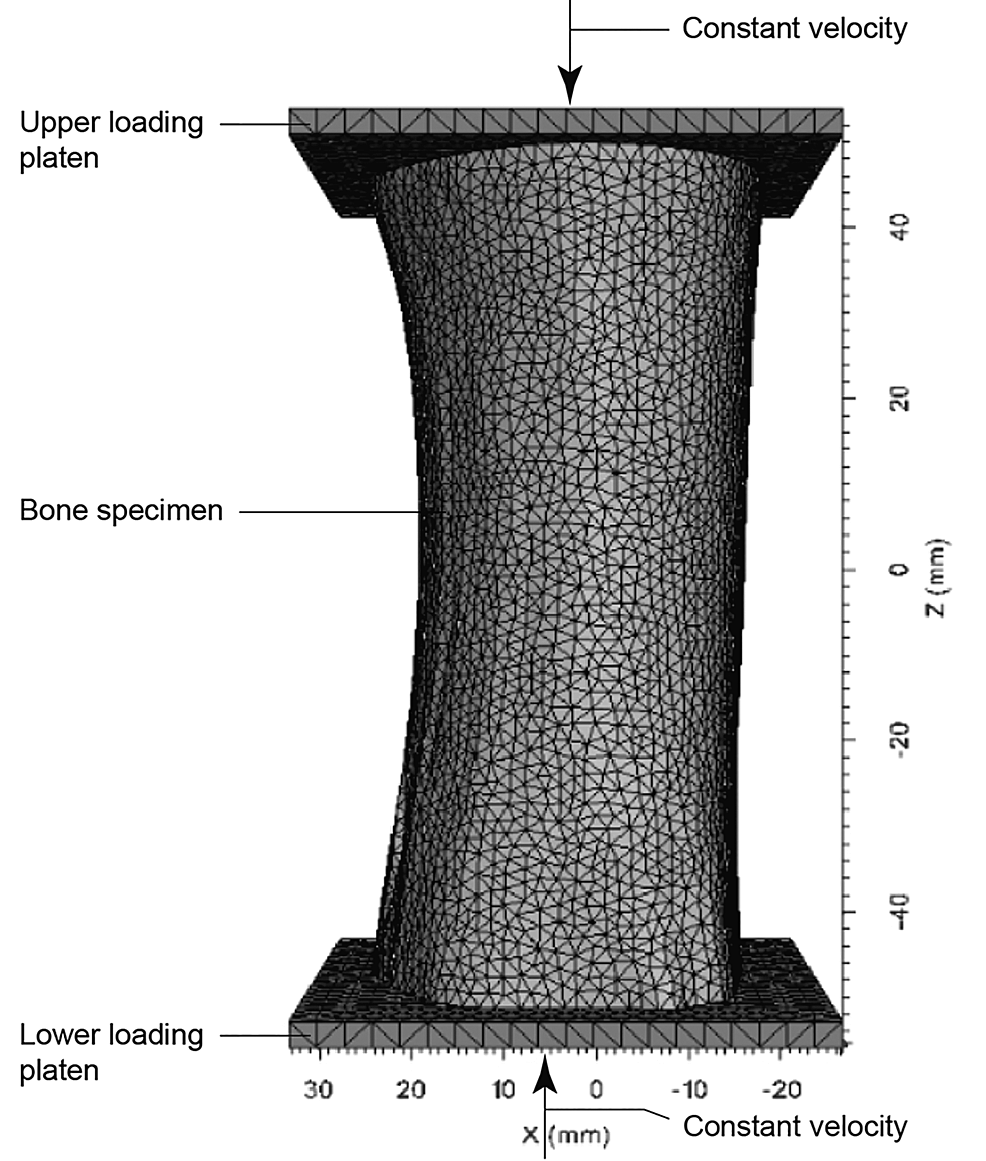 Geometry-and-boundary-conditions-of-compression-test-simulation-on-bone-specimen.