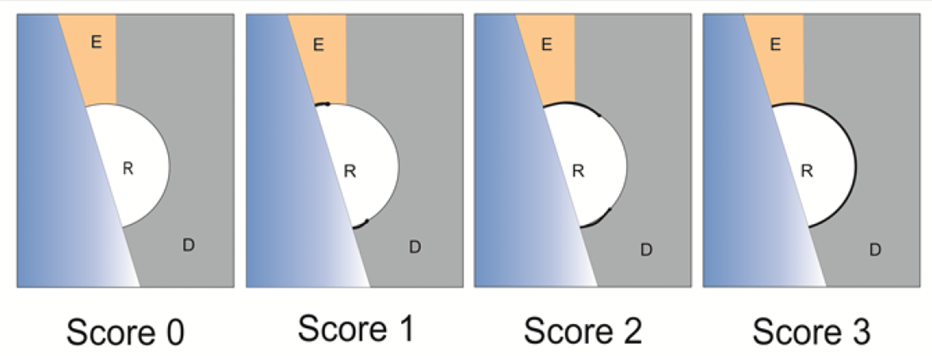 Cureus | Comparative Evaluation Of Microleakage In Class II ...