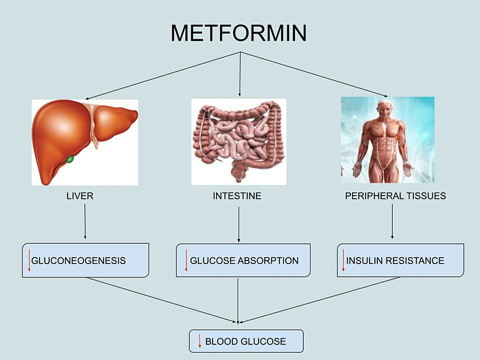 Cureus Metformin for the Improvement of Comorbid Depression Symptoms