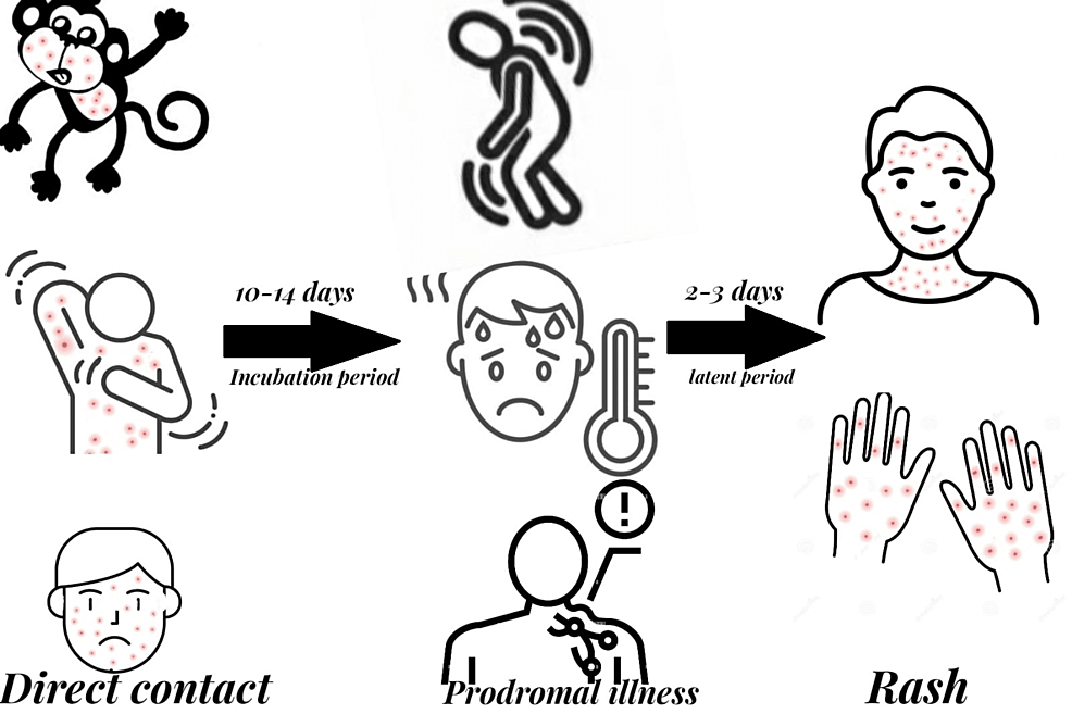 This figure demonstrates newly developing monkeypox lesions along the