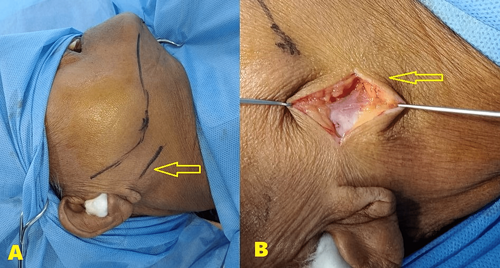 Preoperative-and-intraoperative-images