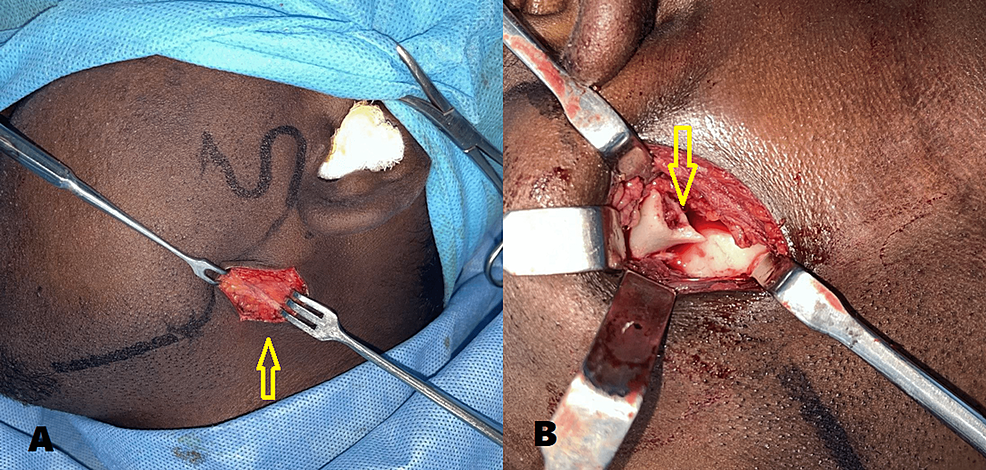 Intraoperative-images