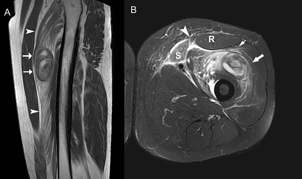 A-27-year-old-male-with-a-laceration-anterior-to-the-thigh.