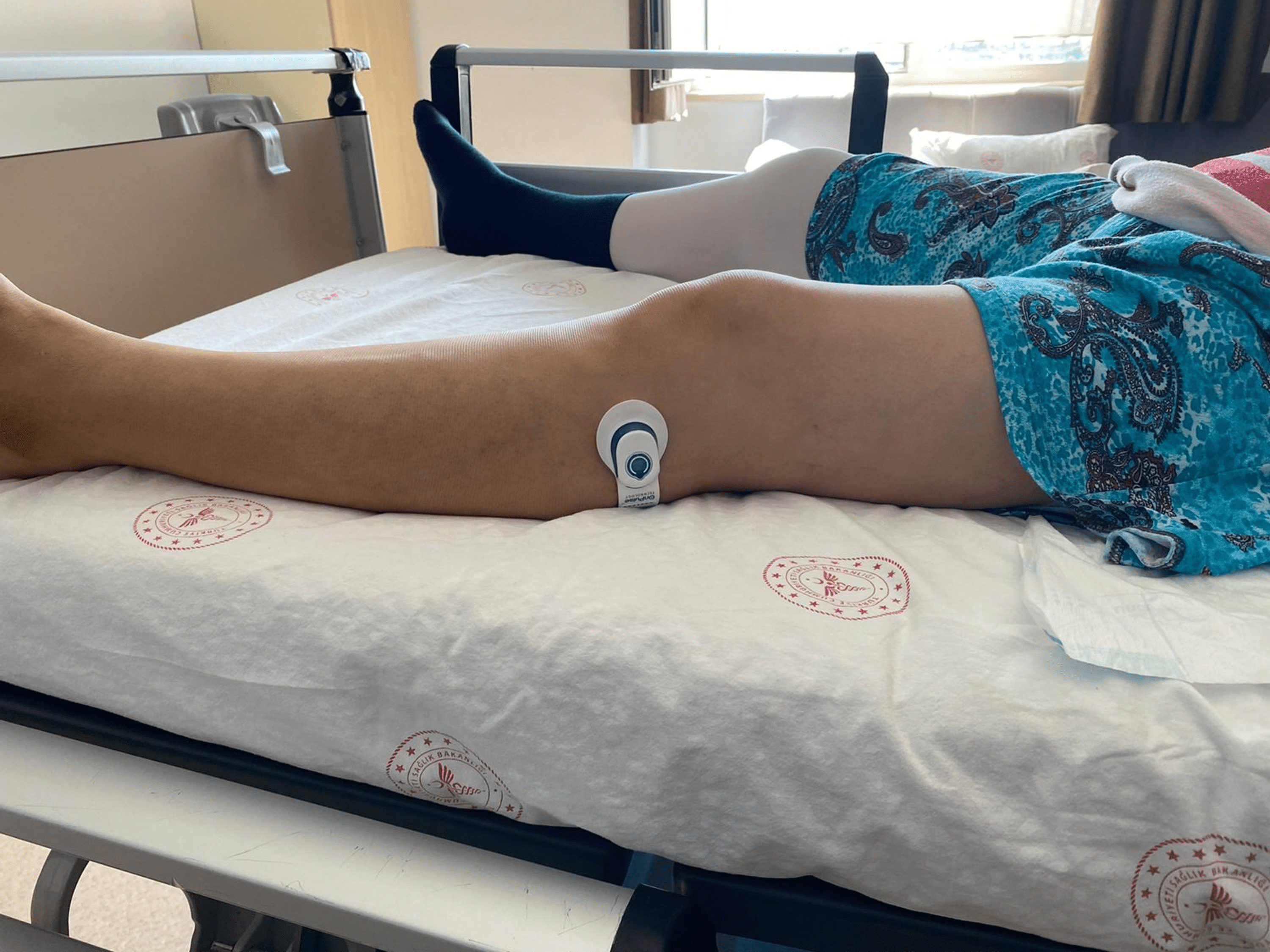 Cureus | Role of Neuromuscular Electrical Stimulation in Increasing Femoral  Venous Blood Flow After Total Hip Prosthesis