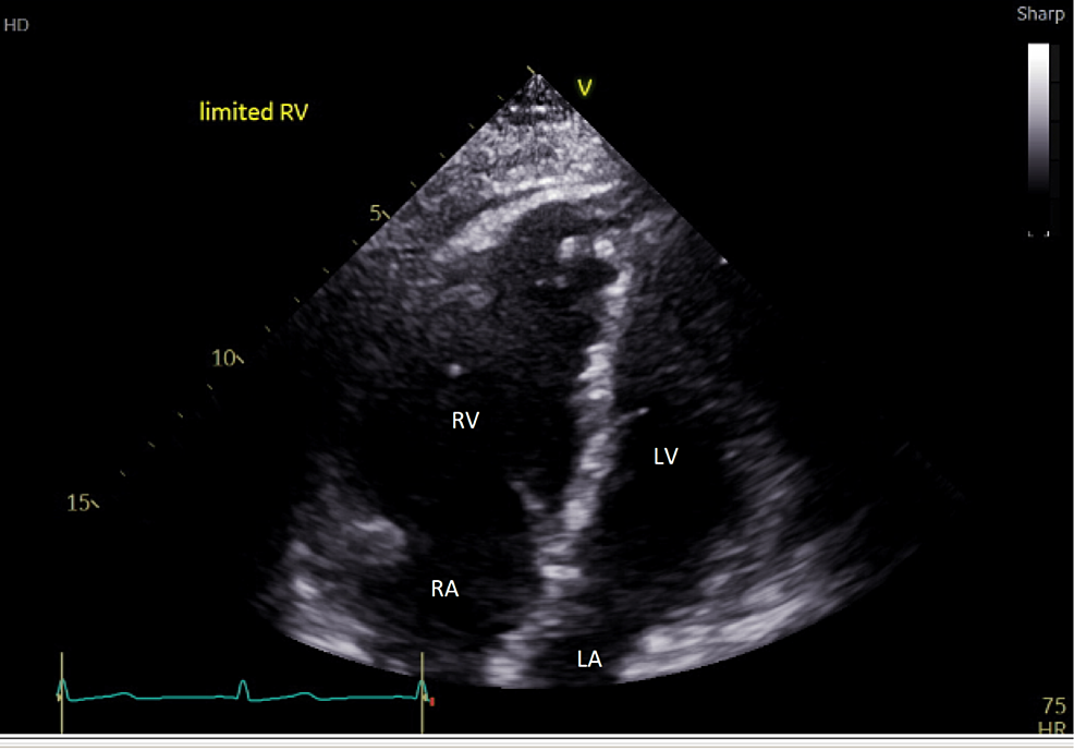 Cureus | Use of Point-of-Care Ultrasound and Focus-Assessed ...